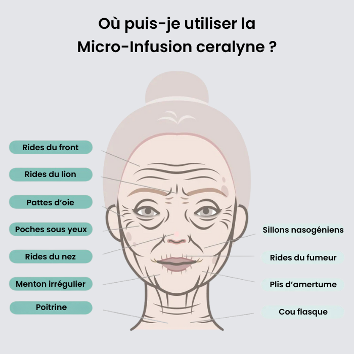 Micro-Infusion Lift Pro + Sérum extra offert